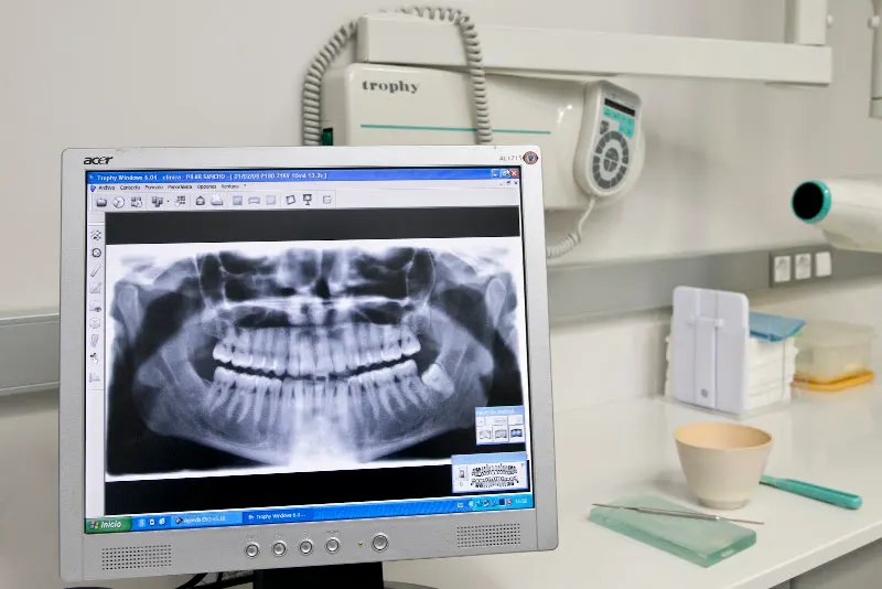 Clínica Dental Gloria Sancho - Tu dentista en Figueres