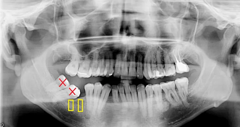 Clinica Dental D. Georg Esch