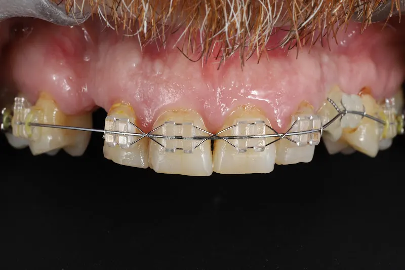 Clínica Dental Franch-Adriaens Odontología Avanzada