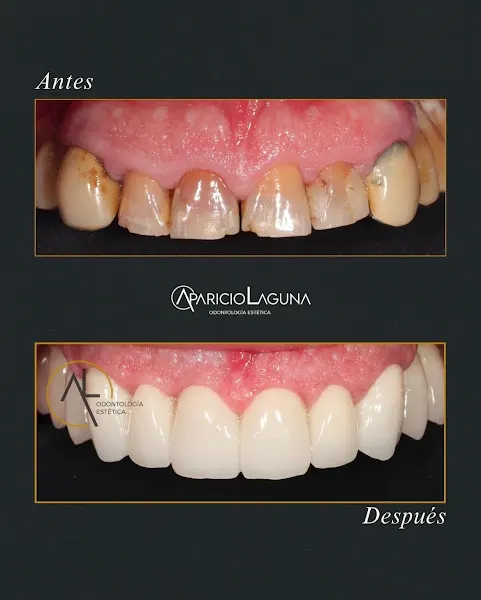 Aparicio Laguna - Clínica Dental
