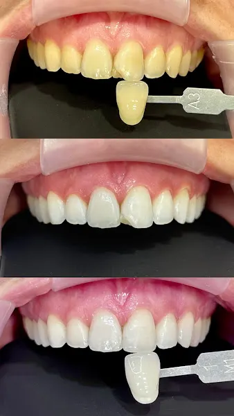 Clínica Dental Llompart Inca