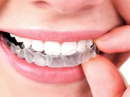 Ica Dental - Clínica dental en Puerto de la Cruz - foto 2