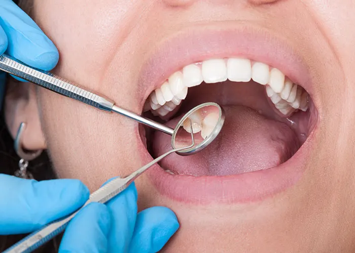 Clínica Dental J.J. Mas - Dentista en Crevillente - foto 2