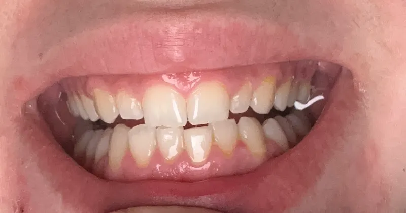 BROTONS DENTAL - Algemesí