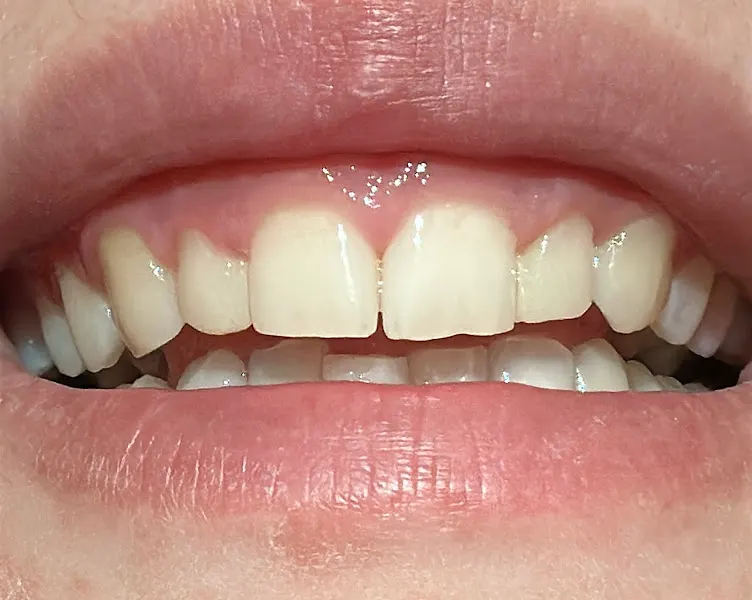 BROTONS DENTAL - Clínica dental en Algemesí - foto 2