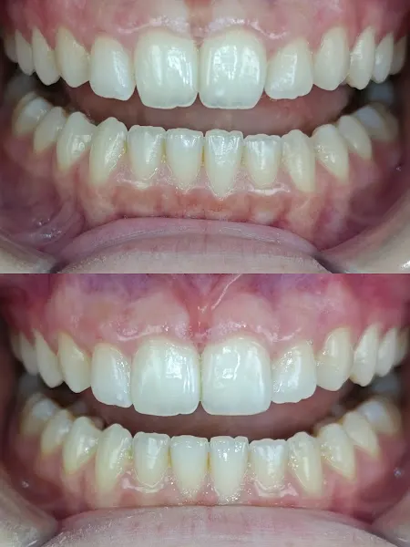 Clínica Bioestética Dental - Martos y Jaén
