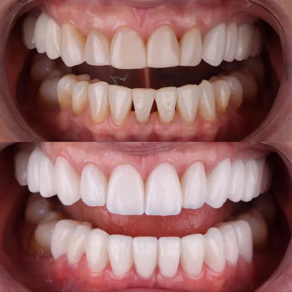 Clínica Dental San Magno | Expertos Estética Dental | Ortodoncia Invisible - Clínica dental en Altea - foto 3