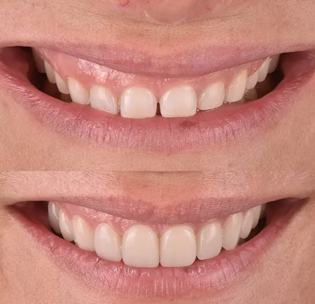 Clínica Dental Dra. Kenny Perero Pin - Jerez de los Caballeros