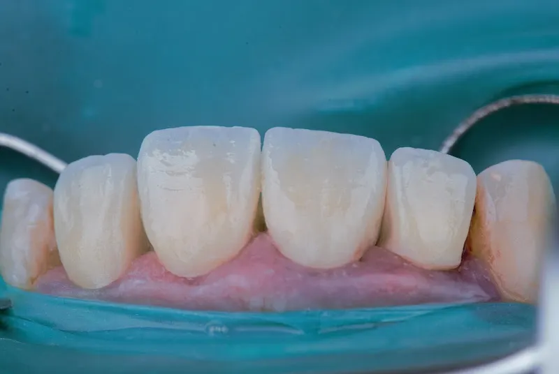 Clinica Dental Opal