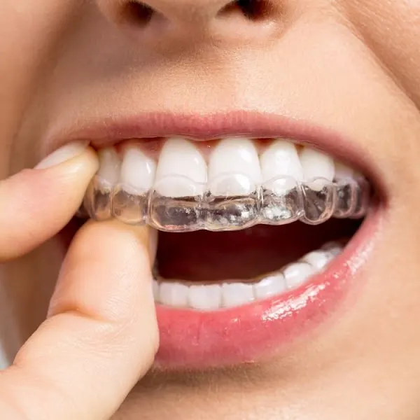 Clínica Dental Dr. Santiago Baños - Clínica dental en Barcelona - foto 2
