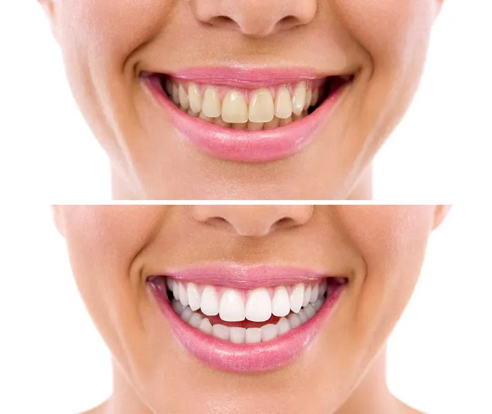 Clínica Dental Dr. Joaquín Anmella - L'Hospitalet de Llobregat