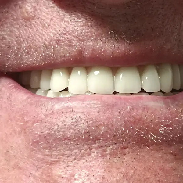 Akdent odontología avanzada