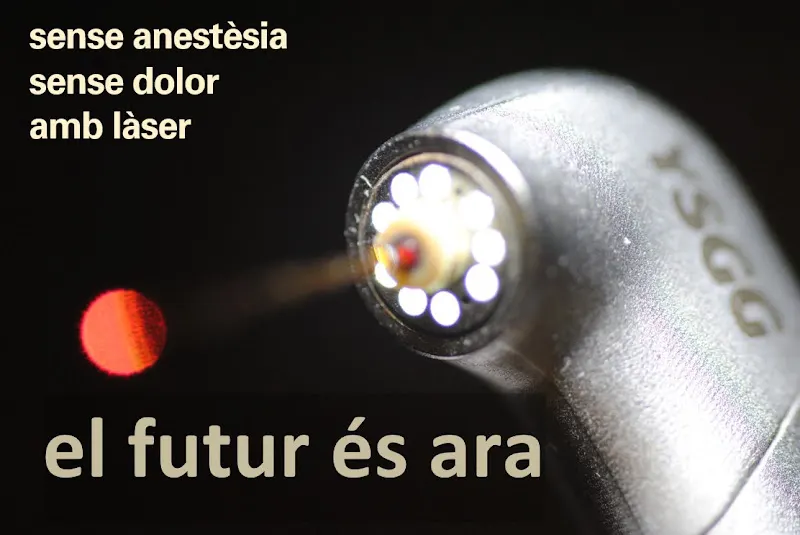 Badia & Lloret ODONTOLOGIA LÀSER. Dr. Jordi Badia Farré / Dra. Núria Lloret Porcel