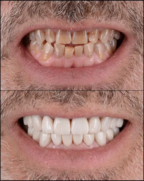 Dr Azrak Odontologia Avançada | Clínica Dental