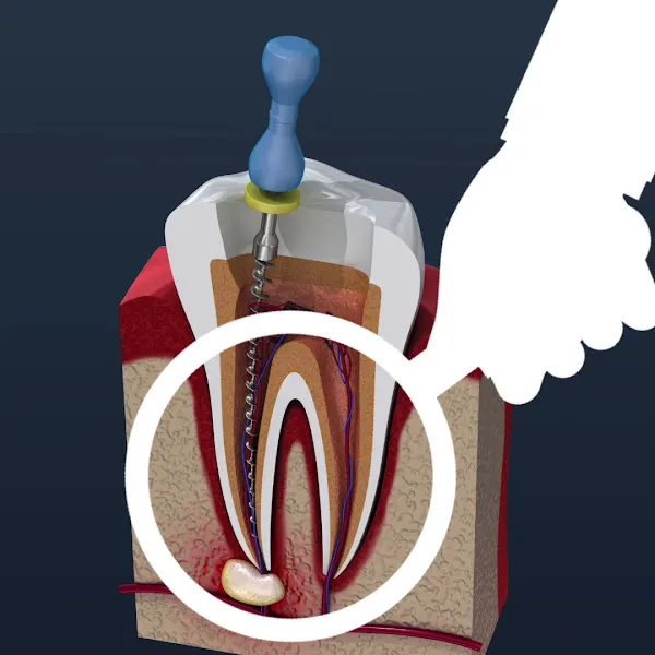 TAC Dental Nuñez – Portal Informativo para Dentistas Colegiados. - Barcelona