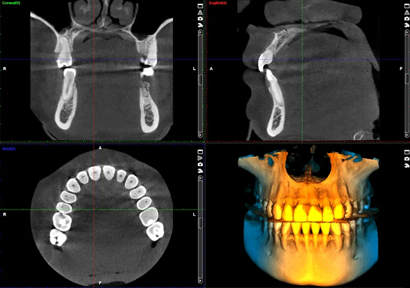 C3D PALMA MALLORCA - CENTRO DE DIAGNOSTICO AVANZADO (ODONTOLOGÍA DIGITAL) - Clínica dental en Palma - foto 2