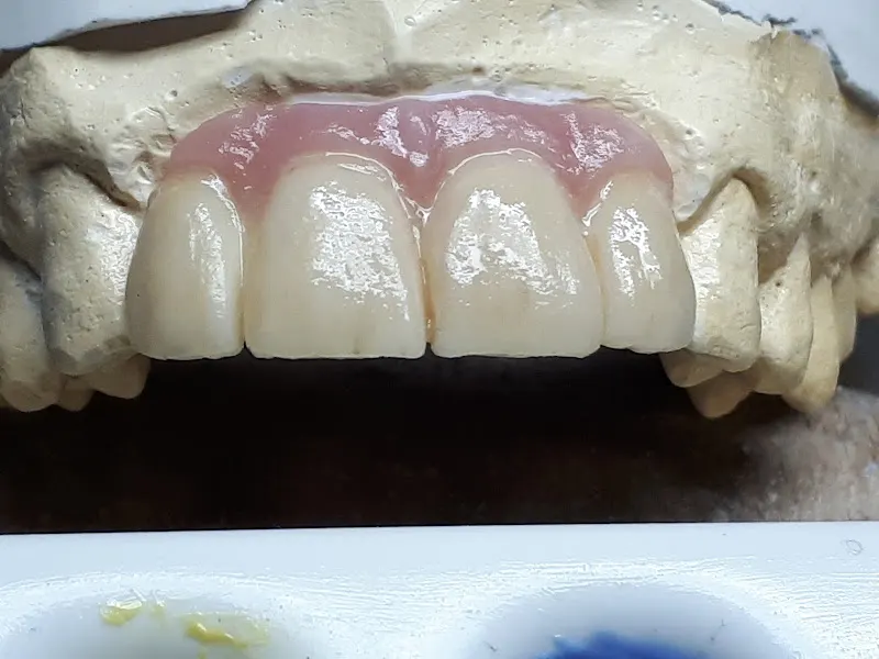 Clínica Dental Coristanco