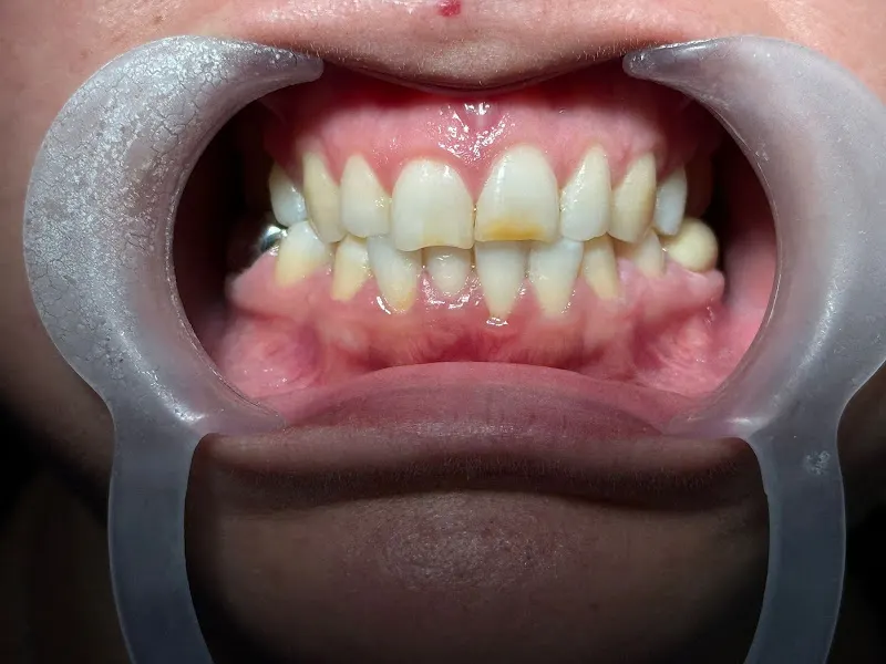 Clinica Dental San Francisco de Asís - Torrevieja