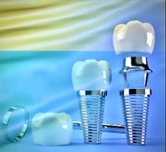 Tandläkeriet - Periodoncista de implantes dentales en Torrevieja - foto 2