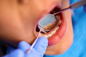 Blog 2 close up of black kid during dental appointment at 2024 12 13 21 02 22 utc